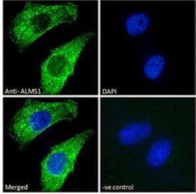 Immunocytochemistry/ Immunofluorescence: ALMS1 Antibody [NB100-1195]