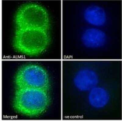 Immunocytochemistry/ Immunofluorescence: ALMS1 Antibody [NB100-1195]