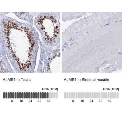 Immunohistochemistry-Paraffin: ALMS1 Antibody [NBP1-83015]