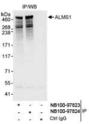 Immunoprecipitation: ALMS1 Antibody [NB100-97824]