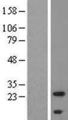 Western Blot: ALMS1P Overexpression Lysate [NBL1-12583]