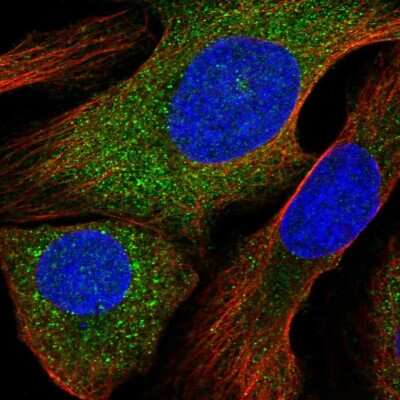 Immunocytochemistry/ Immunofluorescence: ALOX12B Antibody [NBP1-89409]