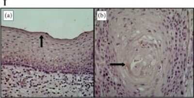 Immunohistochemistry: ALOX12B Antibody [NBP1-89409]