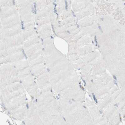 Immunohistochemistry-Paraffin: ALOX12B Antibody [NBP1-89409]