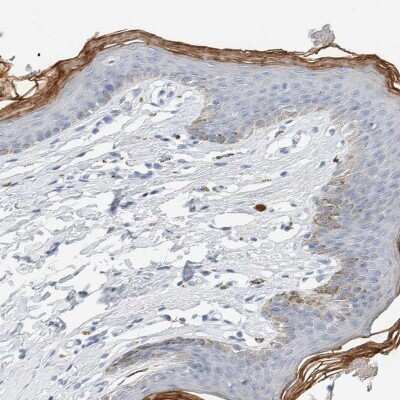 Immunohistochemistry-Paraffin: ALOX12B Antibody [NBP1-89409]