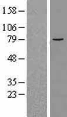 Western Blot: ALOX12B Overexpression Lysate [NBL1-07480]