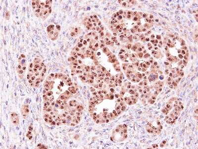 Immunohistochemistry-Paraffin: ALOXE3 Antibody [NBP1-32533]