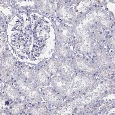 Immunohistochemistry-Paraffin: ALOXE3 Antibody [NBP2-62727]