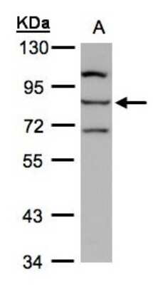 Western Blot: ALOXE3 Antibody [NBP1-32533]