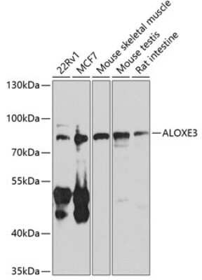 Western Blot: ALOXE3 AntibodyBSA Free [NBP2-92686]