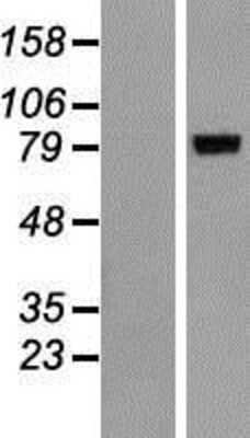 Western Blot: ALOXE3 Overexpression Lysate [NBP2-06525]