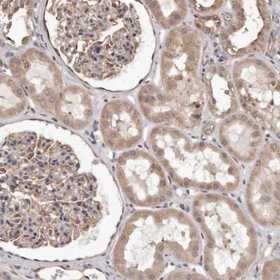 Immunohistochemistry-Paraffin: ALPK1 Antibody [NBP1-83593]