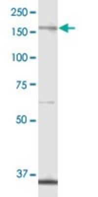 Western Blot: ALPK1 Antibody [H00080216-B01P]