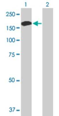 Western Blot: ALPK1 Antibody [H00080216-B01P]