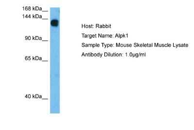 Western Blot: ALPK1 Antibody [NBP2-86982]