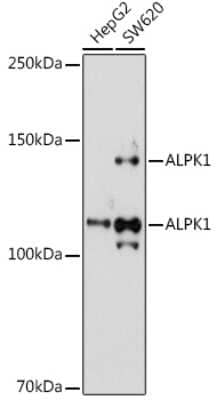 Western Blot: ALPK1 AntibodyAzide and BSA Free [NBP3-15997]