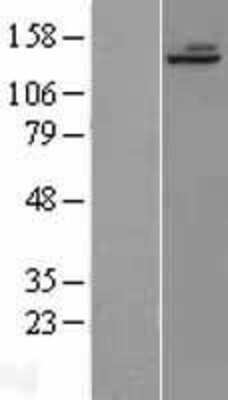 Western Blot: ALPK1 Overexpression Lysate [NBL1-07486]