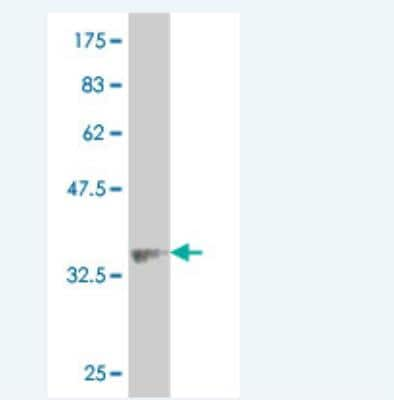 Western Blot: ALPK2 Antibody (4E5) [H00115701-M05]