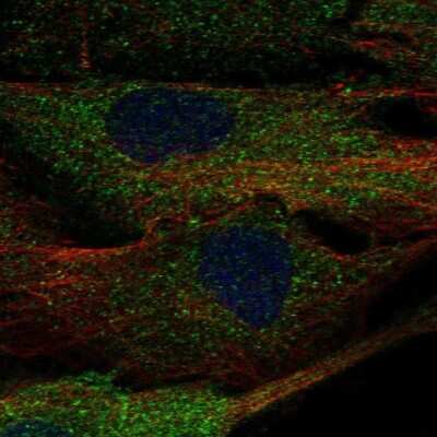 Immunocytochemistry/ Immunofluorescence: ALPK2 Antibody [NBP1-83295]