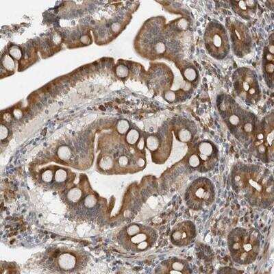 Immunohistochemistry: ALPK2 Antibody [NBP1-83297]