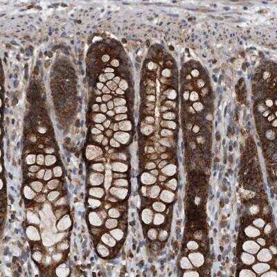 Immunohistochemistry-Paraffin: ALPK2 Antibody [NBP1-83295]