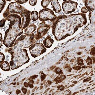 Immunohistochemistry-Paraffin: ALPK2 Antibody [NBP1-83296]