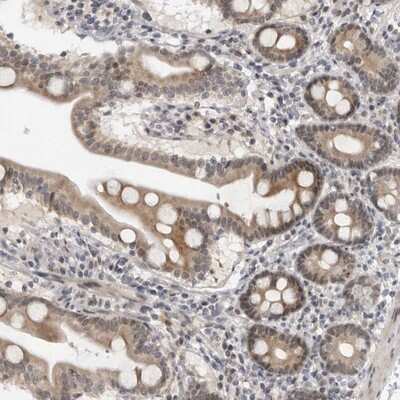 Immunohistochemistry-Paraffin: ALPK2 Antibody [NBP1-83298]