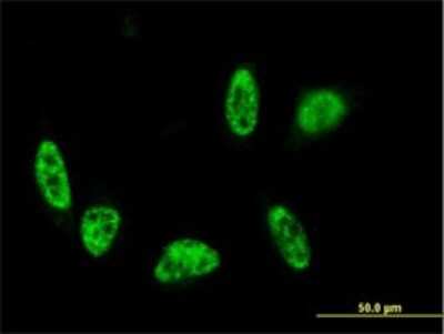 Immunocytochemistry/ Immunofluorescence: ALPK3 Antibody (4G4) [H00057538-M01]