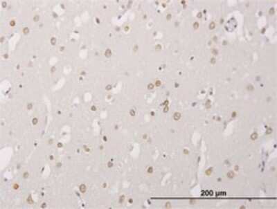 Immunohistochemistry-Paraffin: ALPK3 Antibody (4G4) [H00057538-M01]