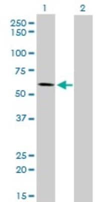 Western Blot: ALPPL2 Antibody (2B3) [H00000251-M07]