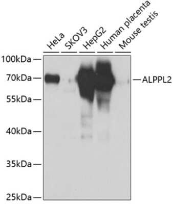 Western Blot: ALPPL2 AntibodyBSA Free [NBP2-92478]