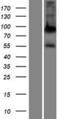 Western Blot: ALPPL2 Overexpression Lysate [NBP2-06138]