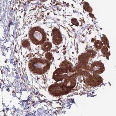 Immunohistochemistry-Paraffin: ALS2CL Antibody [NBP2-30434]