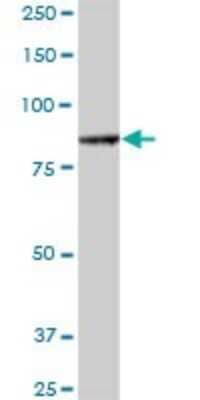 Western Blot: ALS2CL Antibody [H00259173-B01P]