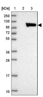 Western Blot: ALS2CL Antibody [NBP2-30434]