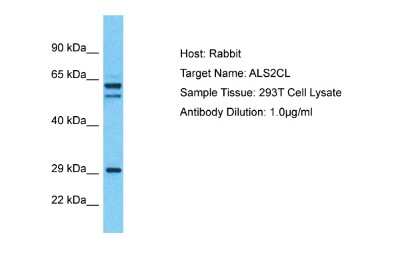 Western Blot: ALS2CL Antibody [NBP2-84422]