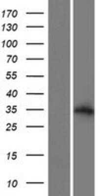 Western Blot: ALS2CL Overexpression Lysate [NBP2-04811]