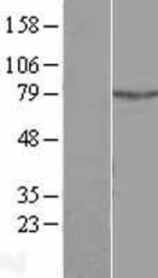 Western Blot: ALS2CR11 Overexpression Lysate [NBL1-07489]