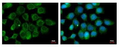 Immunocytochemistry/ Immunofluorescence: ALS2CR12 Antibody [NBP2-15366]