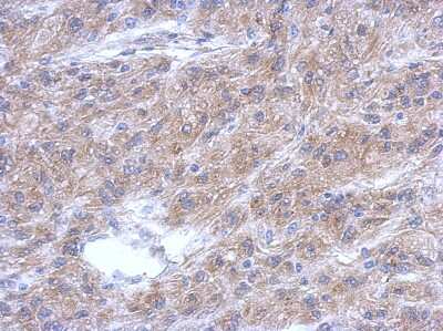 Immunohistochemistry-Paraffin: ALS2CR12 Antibody [NBP2-15366]