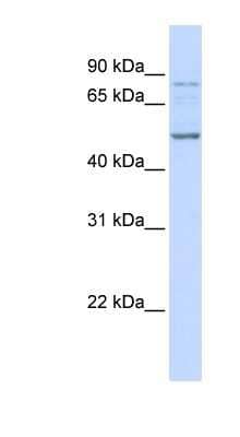 Western Blot: ALS2CR12 Antibody [NBP1-70405]