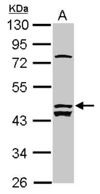 Western Blot: ALS2CR12 Antibody [NBP2-15366]