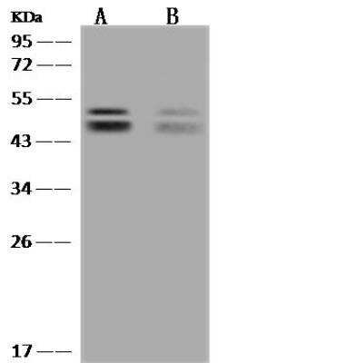 Western Blot: ALS2CR12 Antibody [NBP3-05958]