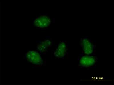 Immunocytochemistry/ Immunofluorescence: ALS2CR15 Antibody [H00130026-B01P]