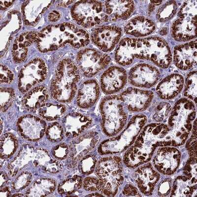 Immunohistochemistry-Paraffin: ALS2CR15 Antibody [NBP1-90185]