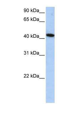 Western Blot: ALS2CR15 Antibody [NBP1-56711]