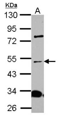 Western Blot: ALS2CR15 Antibody [NBP2-15367]