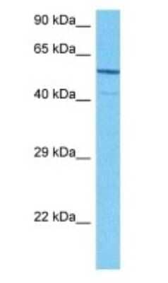 Western Blot: ALS2CR15 Antibody [NBP3-10619]