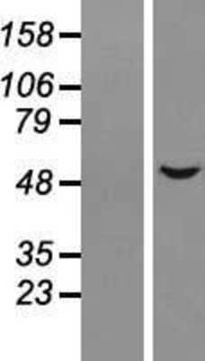 Western Blot: ALS2CR15 Overexpression Lysate [NBL1-11803]