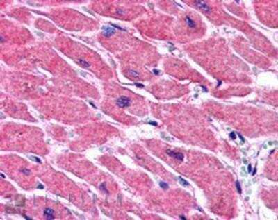 Immunohistochemistry: ALS2CR2 Antibody [NB100-1181]